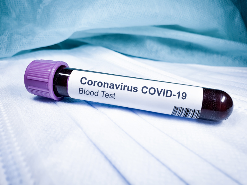 How To Protect Yourself and Your Family From The Coronavirus